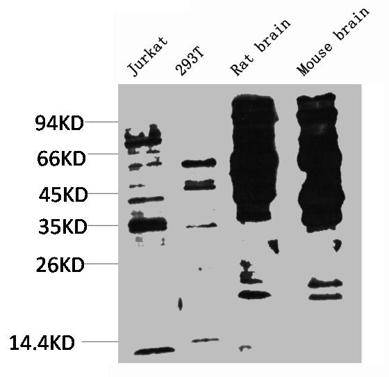 Western blot analysis of 1) Jurkat, 2) 293T, 3) Rat Brain Tissue, 4) Mouse Brain Tissue with Phosphotyrosine Mouse mAb diluted at 1:2,000.
