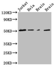 Western blot analysis of Recombinant ECFP Protein using ECFP-Tag Monoclonal Antibody.