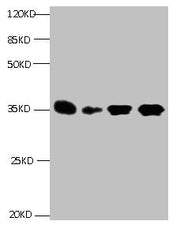 All lanes: Mouse anti- Human Insulin-like growth factor-binding protein 1 monoclonal antibody at 1ug/ml Lane 1:Pyrolysis liquid human placental tissue 7.5ug/ml Lane 2:Pyrolysis liquid human placental tissue 3.25ug/ml Lane 3:IGFBP1 transfected SF9...