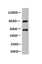 All lanes: Mouse anti-human Platelet-activating factor acetylhydrolase monoclonal Antibody at 1ug/ml Lane 1:mouse spleen tissue Secondary:HRP labeled Goat polyclonal to Mouse IgG at 1/3000 dilution Predicted band size : 48kd Observed band size : 4...
