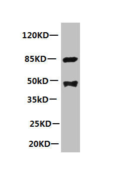 All lanes: Mouse anti-human Platelet-activating factor acetylhydrolase monoclonal Antibody at 1ug/ml Lane 1:mouse spleen tissue Secondary:HRP labeled Goat polyclonal to Mouse IgG at 1/3000 dilution Predicted band size : 48kd Observed band size : 4...