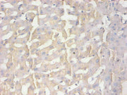 Immunohistochemical of paraffin-embedded human liver tissue using CSB-MA100091A0m at dilution of 1:200
