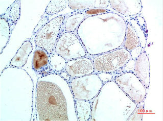 Immunohistochemical analysis of paraffin-embedded Human Thyroid Tissue using TTR Mouse mAb diluted at 1:200.