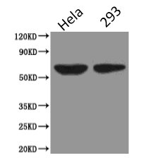 Western Blot Positive WB detected in: Hela whole cell lysate, HEK293 whole cell lysate All lanes: PODXL antibody at 2.5µg/ml Secondary Goat polyclonal to Mouse IgG at 1/5000 dilution Predicted band size: 59, 56 kDa Observed band size: 59 kDa