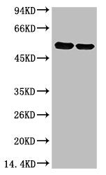 Western blot analysis of Arabidopsis with Rubisco(Large Chain) Mouse mAb diluted at 1)1:2,000；2)1:5,000