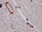 IHC image of CSB-MA166134 diluted at 1:100 and staining in paraffin-embedded human heart tissue performed on a Leica BondTM system. After dewaxing and hydration, antigen retrieval was mediated by high pressure in a citrate buffer (pH 6.0). Section...