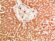 Immunohistochemical analysis of paraffin-embedded Human Liver Carcinoma Tissue using Collagen IV Mouse mAb diluted at 1:200.