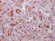 IHC image of CSB-MA177758 diluted at 1:100 and staining in paraffin-embedded human placenta tissue performed on a Leica BondTM system. After dewaxing and hydration, antigen retrieval was mediated by high pressure in a citrate buffer (pH 6.0). Sect...