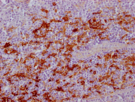 IHC image of CSB-MA179751 diluted at 1:100 and staining in paraffin-embedded human tonsil tissue performed on a Leica BondTM system. After dewaxing and hydration, antigen retrieval was mediated by high pressure in a citrate buffer (pH 6.0). Sectio...