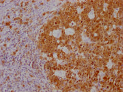 IHC image of CSB-MA181399 diluted at 1:100 and staining in paraffin-embedded human tonsil tissue performed on a Leica BondTM system. After dewaxing and hydration, antigen retrieval was mediated by high pressure in a citrate buffer (pH 6.0). Sectio...