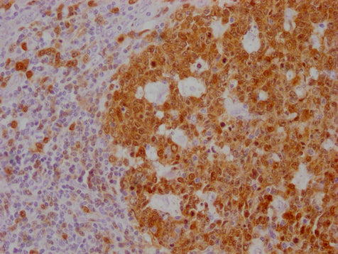 IHC image of CSB-MA181399 diluted at 1:100 and staining in paraffin-embedded human tonsil tissue performed on a Leica BondTM system. After dewaxing and hydration, antigen retrieval was mediated by high pressure in a citrate buffer (pH 6.0). Sectio...