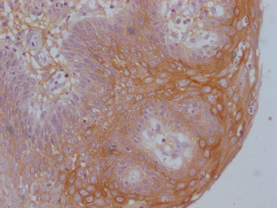 IHC image of CSB-MA192596 diluted at 1:100 and staining in paraffin-embedded human tonsil tissue performed on a Leica BondTM system. After dewaxing and hydration, antigen retrieval was mediated by high pressure in a citrate buffer (pH 6.0). Sectio...