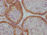 IHC image of CSB-MA196808 diluted at 1:100 and staining in paraffin-embedded human placenta tissue performed on a Leica BondTM system. After dewaxing and hydration, antigen retrieval was mediated by high pressure in a citrate buffer (pH 6.0). Sect...