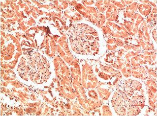 Immunohistochemical analysis of paraffin-embedded Human Kidney Tissue using Collagen IV Mouse mAb diluted at 1:200.