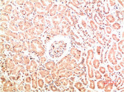 Immunohistochemical analysis of paraffin-embedded Human Kidney Tissue using Collagen IV Mouse mAb diluted at 1:200.