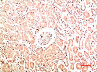 Immunohistochemical analysis of paraffin-embedded Human Kidney Tissue using Collagen IV Mouse mAb diluted at 1:200.