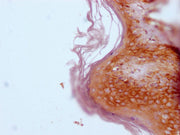 IHC image of CSB-MA247417 diluted at 1:100 and staining in paraffin-embedded human skin tissue performed on a Leica BondTM system. After dewaxing and hydration, antigen retrieval was mediated by high pressure in a citrate buffer (pH 6.0). Section...