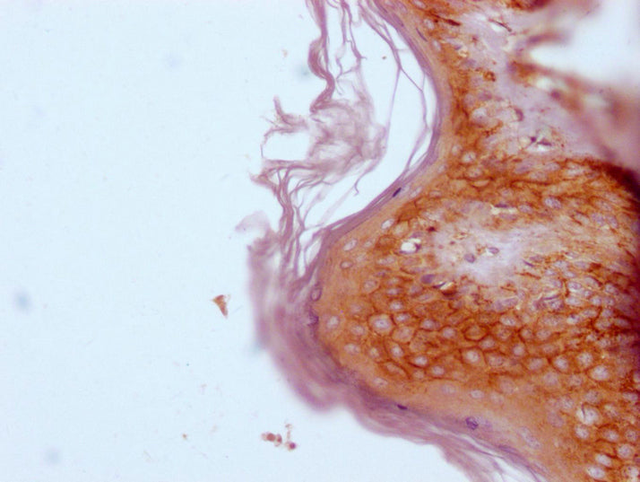IHC image of CSB-MA247417 diluted at 1:100 and staining in paraffin-embedded human skin tissue performed on a Leica BondTM system. After dewaxing and hydration, antigen retrieval was mediated by high pressure in a citrate buffer (pH 6.0). Section...