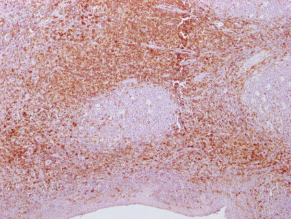 IHC image of CSB-MA269399 diluted at 1:100 and staining in paraffin-embedded human tonsil tissue performed on a Leica BondTM system. After dewaxing and hydration, antigen retrieval was mediated by high pressure in a citrate buffer (pH 6.0). Sectio...