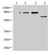 Western Blot Positive WB detected in: 1-3 lanes: Recombinant Enterobacteria phage M13 Attachment protein at 5ng, 10ng, 20ng; 4 lane: Enterobacteria phage M13 Attachment All lanes: Enterobacteria phage M13 III antibody at 1:1000 Secondary Goat poly...