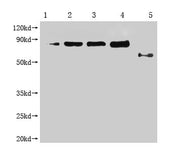 Western Blot Positive WB detected in: 1-4 lanes: Recombinant Enterobacteria phage M13 Attachment protein at 2.5ng, 5ng, 10ng, 20ng; 5 lane: Enterobacteria phage M13 Attachment All lanes: Enterobacteria phage M13 III antibody at 1:1000 Secondary Go...