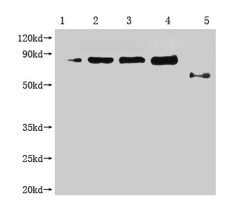 Western Blot Positive WB detected in: 1-4 lanes: Recombinant Enterobacteria phage M13 Attachment protein at 2.5ng, 5ng, 10ng, 20ng; 5 lane: Enterobacteria phage M13 Attachment All lanes: Enterobacteria phage M13 III antibody at 1:1000 Secondary Go...