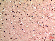 Immunohistochemical analysis of paraffin-embedded Human Brain Tissue using Beclin-1 Mouse mAb diluted at 1:200.
