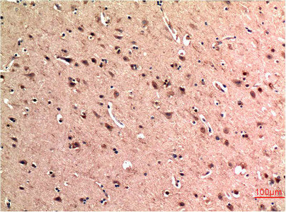 Immunohistochemical analysis of paraffin-embedded Human Brain Tissue using Beclin-1 Mouse mAb diluted at 1:200.