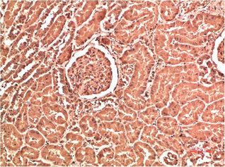 Immunohistochemical analysis of paraffin-embedded Human Kidney Tissue using Collagen IV Mouse mAb diluted at 1:200.