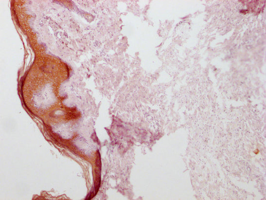 IHC image of CSB-MA555839 diluted at 1:100 and staining in paraffin-embedded human skin tissue performed on a Leica BondTM system. After dewaxing and hydration, antigen retrieval was mediated by high pressure in a citrate buffer (pH 6.0). Section...