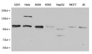 Western Blot Positive WB detected in: U251 whole cell lysate, Hela whole cell lysate, A549 whole cell lysate, K562 whole cell lysate, HepG2 whole cell lysate, MCF-7 whole cell lysate, Jurkat whole cell lysate All lanes: MBTPS1 antibody at 1:1000 S...