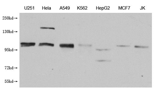 Western Blot Positive WB detected in: U251 whole cell lysate, Hela whole cell lysate, A549 whole cell lysate, K562 whole cell lysate, HepG2 whole cell lysate, MCF-7 whole cell lysate, Jurkat whole cell lysate All lanes: MBTPS1 antibody at 1:1000 S...