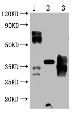 Western Blot Positive WB detected in: 5ug 293 whole cell lysate transfected with PD-1, 25ng recombinant protein from E.coli, 25ng recombinant protein from Mammalian cell PD-1 antibody at 1:1000 Secondary Goat polyclonal to mouse IgG at 1/50000 dil...