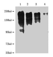 Western Blot Positive WB detected in: 1-4 lanes: 293T whole cell lysate transfected with MERTK at 10ug, 5ug, 2.5ug, 1.25ug All lanes: MERTK antibody at 1:2000 Secondary Goat polyclonal to mouse IgG at 1/50000 dilution Predicted band size: 150-250...