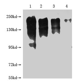 Western Blot Positive WB detected in: 1-4 lanes: 293T whole cell lysate transfected with MERTK at 10ug, 5ug, 2.5ug, 1.25ug All lanes: MERTK antibody at 1:2000 Secondary Goat polyclonal to mouse IgG at 1/50000 dilution Predicted band size: 150-250...