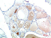 Immunohistochemical analysis of paraffin-embedded Human Thyroid Tissue using TTR Mouse mAb diluted at 1:200.