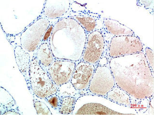 Immunohistochemical analysis of paraffin-embedded Human Thyroid Tissue using TTR Mouse mAb diluted at 1:200.