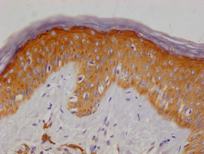 IHC image of CSB-MA731035A0m diluted at 1:50 and staining in paraffin-embedded human skin tissue performed on a Leica BondTM system. After dewaxing and hydration, antigen retrieval was mediated by high pressure in a citrate buffer (pH 6.0). Sectio...