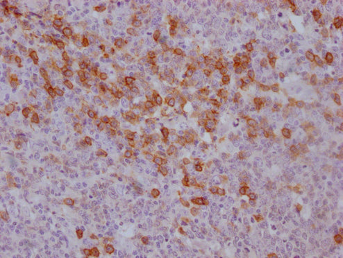 IHC image of CSB-MA785760 diluted at 1:100 and staining in paraffin-embedded human tonsil tissue performed on a Leica BondTM system. After dewaxing and hydration, antigen retrieval was mediated by high pressure in a citrate buffer (pH 6.0). Sectio...