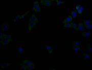 Immunofluorescence staining of Hela cells with（CSB-MA816871A0m）at 1:90, counter-stained with DAPI. The cells were fixed in 4% formaldehyde, permeabilized using 0.2% Triton X-100 and blocked in 10% normal Goat Serum. The cells were then incubated w...
