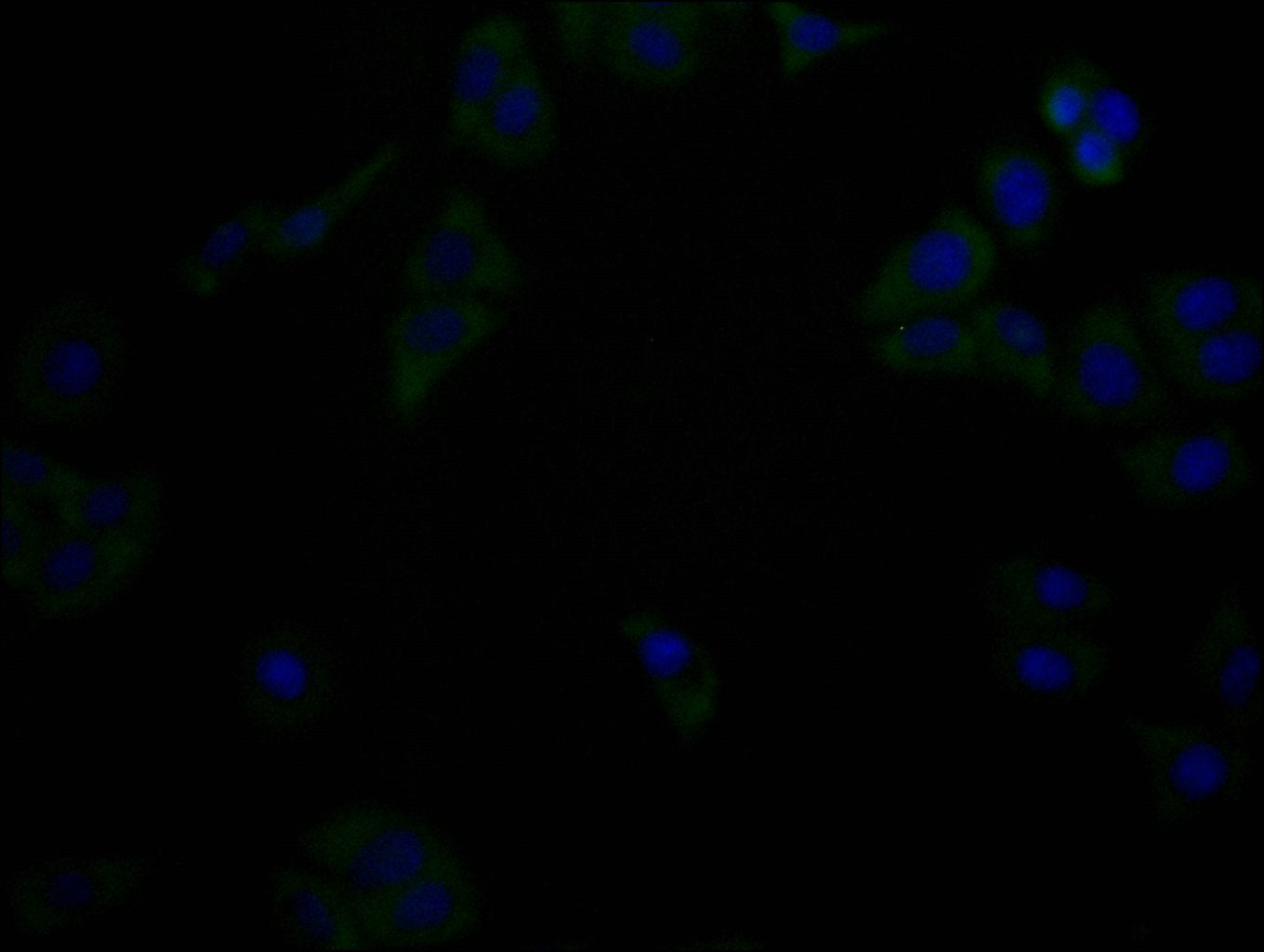 Immunofluorescence staining of Hela cells with（CSB-MA816871A0m）at 1:90, counter-stained with DAPI. The cells were fixed in 4% formaldehyde, permeabilized using 0.2% Triton X-100 and blocked in 10% normal Goat Serum. The cells were then incubated w...