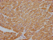 IHC image of CSB-MA829166 diluted at 1:100 and staining in paraffin-embedded human heart tissue performed on a Leica BondTM system. After dewaxing and hydration, antigen retrieval was mediated by high pressure in a citrate buffer (pH 6.0). Section...