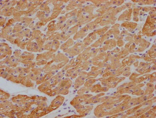 IHC image of CSB-MA829166 diluted at 1:100 and staining in paraffin-embedded human heart tissue performed on a Leica BondTM system. After dewaxing and hydration, antigen retrieval was mediated by high pressure in a citrate buffer (pH 6.0). Section...