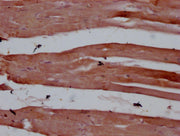 IHC image of CSB-MA830329 diluted at 1:100 and staining in paraffin-embedded human skeletal muscle tissue performed on a Leica BondTM system. After dewaxing and hydration, antigen retrieval was mediated by high pressure in a citrate buffer (pH 6.0...