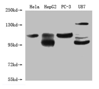 Western Blot Positive WB detected in: Hela whole cell lysate, HepG2 whole cell lysate, PC-3 whole cell lysate, U87 whole cell lysate All lanes: Alix antibody at 1:1000 Secondary Goat polyclonal to mouse IgG at 1/50000 dilution Predicted band size:...
