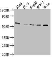 Western Blot Positive WB detected in: A549 whole cell lysate, PC-3 whole cell lysate, HepG2 whole cell lysate, MCF-7 whole cell lysate, Hela whole cell lysate All lanes: PD-L1 antibody at 1:2500 Secondary Goat polyclonal to Mouse IgG at 1/10000 di...