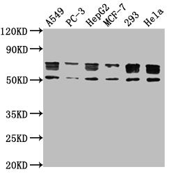 Western Blot Positive WB detected in: A549 whole cell lysate, PC-3 whole cell lysate, HepG2 whole cell lysate, MCF-7 whole cell lysate, 293 whole cell lysate, Hela whole cell lysate All lanes: PD-L1 antibody at 1:1000 Secondary Goat polyclonal to...