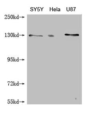 Western Blot Positive WB detected in: SY-5Y whole cell lysate, Hela whole cell lysate, U87 whole cell lysate All lanes: MCM9 antibody at 1:1000 Secondary Goat polyclonal to mouse IgG at 1/50000 dilution Predicted band size: 128, 73, 44, 85 kDa Obs...