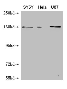 Western Blot Positive WB detected in: SY-5Y whole cell lysate, Hela whole cell lysate, U87 whole cell lysate All lanes: MCM9 antibody at 1:1000 Secondary Goat polyclonal to mouse IgG at 1/50000 dilution Predicted band size: 128, 73, 44, 85 kDa Obs...