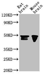 Western Blot Positive WB detected in: Rat brain tissue, Mouse brain tissue All lanes: NANOG antibody at 1:500 Secondary Goat polyclonal to Mouse IgG at 1/10000 dilution Predicted band size: 35, 33 kDa Observed band size: 46, 42 kDa